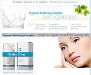 Skin Lightening Cream for Scars,  Pigmentation,  Dark Spots!