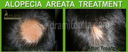 Ayurvedic Hair Treatments :Hair Specialist Ayurvedic  - Dr. Amit Dutta
