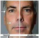 LOOK 10YEARS YOUNGER ,  NEW NHT WRINKLE FREE GUARANTEED IN SECONDS