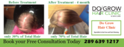 Advanced Laser Hair Therapy
