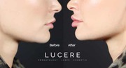 Botox treatment lip plumpers