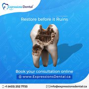 Dental Treatments | Dental Health Services | Expressions Dental