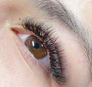  laser hair removal treatment in calgary