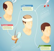 Hair transplant cost