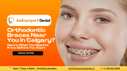 Looking for Orthodontic Braces Near You in Calgary