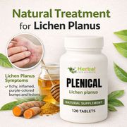 How to Get Rid of Lichen Planus Naturally